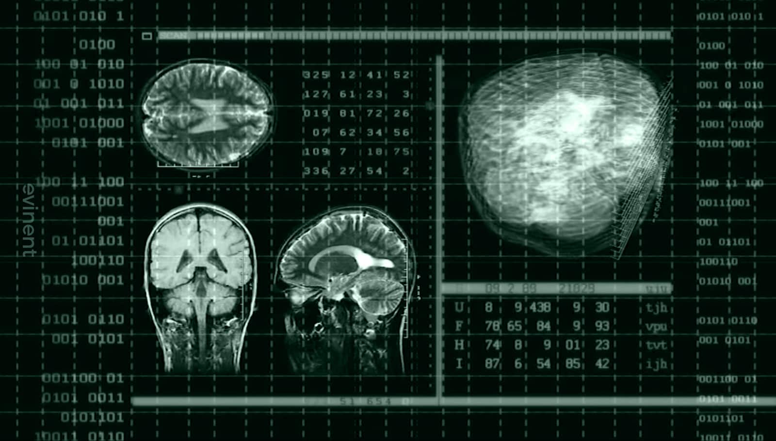 example-of-watson-for-oncology-in-action